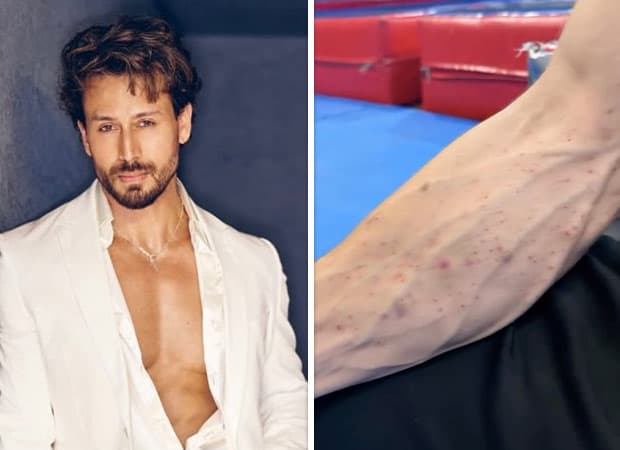 Tiger Shroff Shares Video of Injuries After Mumbai Shooting Incident